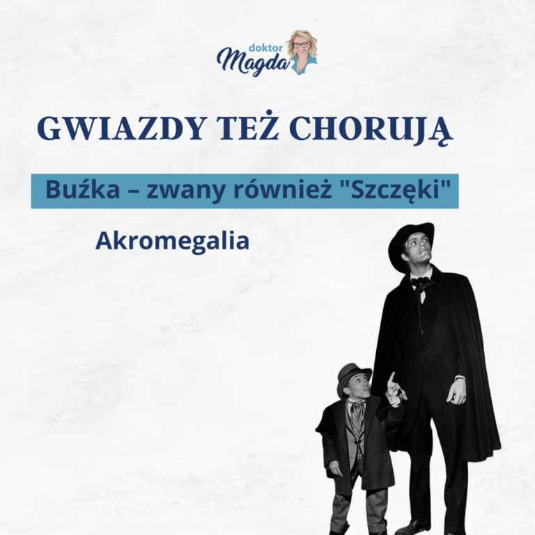 Read more about the article Akromegalia. Gigantyzm. Wysokorosłość.